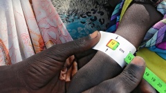 Bei einem Baby im Südsudan wird der Armumfang gemessen. 